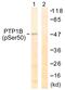 Protein Tyrosine Phosphatase Non-Receptor Type 1 antibody, PA5-38422, Invitrogen Antibodies, Western Blot image 