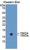 VIP peptides antibody, LS-C296975, Lifespan Biosciences, Western Blot image 