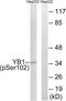 Y-Box Binding Protein 1 antibody, GTX55373, GeneTex, Western Blot image 