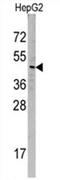 Sorting Nexin 6 antibody, AP11454PU-N, Origene, Western Blot image 