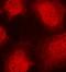 Coactivator Associated Arginine Methyltransferase 1 antibody, orb14700, Biorbyt, Immunofluorescence image 