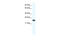 Cbp/P300 Interacting Transactivator With Glu/Asp Rich Carboxy-Terminal Domain 4 antibody, 28-639, ProSci, Western Blot image 