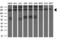 Zinc Finger E-Box Binding Homeobox 1 antibody, LS-C797950, Lifespan Biosciences, Western Blot image 