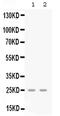 C-X-C Motif Chemokine Ligand 3 antibody, PA5-79111, Invitrogen Antibodies, Western Blot image 