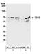 Antigen-presenting glycoprotein CD1d antibody, A304-422A, Bethyl Labs, Western Blot image 