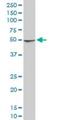 NADH:Ubiquinone Oxidoreductase Subunit A9 antibody, H00004704-M01, Novus Biologicals, Western Blot image 