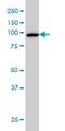 Chromosome Segregation 1 Like antibody, H00001434-M08, Novus Biologicals, Western Blot image 