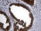 Proteasome Subunit Alpha 7 antibody, LS-C792438, Lifespan Biosciences, Immunohistochemistry paraffin image 