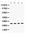 High Mobility Group Box 1 antibody, A00066-1, Boster Biological Technology, Western Blot image 