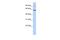 TUB Like Protein 2 antibody, A14349, Boster Biological Technology, Western Blot image 