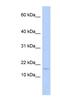 Iron-Sulfur Cluster Assembly 2 antibody, NBP1-54718, Novus Biologicals, Western Blot image 