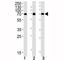 Ribosomal Protein S6 Kinase B2 antibody, F40230-0.4ML, NSJ Bioreagents, Western Blot image 