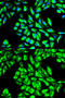 Eukaryotic Translation Elongation Factor 1 Alpha 1 antibody, STJ23475, St John