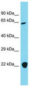 Adaptor Related Protein Complex 4 Subunit Beta 1 antibody, TA332032, Origene, Western Blot image 