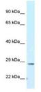 Transmembrane Protein 106B antibody, NBP1-91311, Novus Biologicals, Western Blot image 
