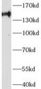 AF4/FMR2 Family Member 4 antibody, FNab00196, FineTest, Western Blot image 