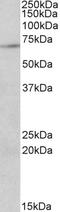 Protein Arginine Methyltransferase 5 antibody, STJ71983, St John