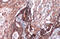 CMP-N-acetylneuraminate-beta-galactosamide-alpha-2,3-sialyltransferase 1 antibody, GTX106121, GeneTex, Immunohistochemistry paraffin image 