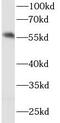 Interferon Regulatory Factor 5 antibody, FNab04392, FineTest, Western Blot image 