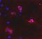 Glutamate Metabotropic Receptor 6 antibody, PA1-46253, Invitrogen Antibodies, Immunofluorescence image 