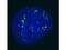 Keratin 6B antibody, PA1-31853, Invitrogen Antibodies, Immunofluorescence image 