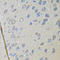 Cadherin 16 antibody, A07518-2, Boster Biological Technology, Immunohistochemistry frozen image 