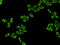 Eukaryotic Translation Elongation Factor 2 antibody, STJ99117, St John