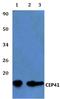 CEP41 antibody, A10862, Boster Biological Technology, Western Blot image 