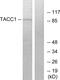 Transforming Acidic Coiled-Coil Containing Protein 1 antibody, GTX87189, GeneTex, Western Blot image 