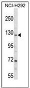 Poly(ADP-Ribose) Glycohydrolase antibody, AP53163PU-N, Origene, Western Blot image 