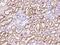 Zinc Finger DHHC-Type Containing 4 antibody, 203218-T08, Sino Biological, Immunohistochemistry paraffin image 