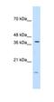 Transcription Factor B2, Mitochondrial antibody, orb330061, Biorbyt, Western Blot image 