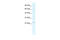 SRY-Box 14 antibody, 28-335, ProSci, Western Blot image 