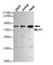 MutL Homolog 1 antibody, STJ99207, St John