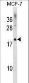 CKLF Like MARVEL Transmembrane Domain Containing 5 antibody, LS-C159375, Lifespan Biosciences, Western Blot image 
