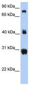 Fibrinogen C Domain Containing 1 antibody, TA339634, Origene, Western Blot image 