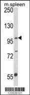 Anoctamin 5 antibody, 63-528, ProSci, Western Blot image 