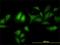 Adhesion Regulating Molecule 1 antibody, H00011047-M01, Novus Biologicals, Immunofluorescence image 