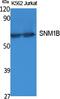 DNA Cross-Link Repair 1B antibody, A06378, Boster Biological Technology, Western Blot image 