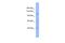 Rho GTPase Activating Protein 20 antibody, A11659, Boster Biological Technology, Western Blot image 