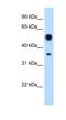 Argininosuccinate Lyase antibody, NBP1-55124, Novus Biologicals, Western Blot image 