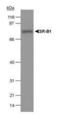 Scavenger Receptor Class B Member 1 antibody, PA1-16803, Invitrogen Antibodies, Western Blot image 