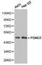 Proteasome 26S Subunit, ATPase 5 antibody, A05480, Boster Biological Technology, Western Blot image 