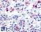 Prolactin Releasing Hormone Receptor antibody, LS-A3821, Lifespan Biosciences, Immunohistochemistry frozen image 