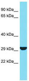 Serine protease 33 antibody, TA331618, Origene, Western Blot image 