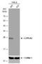 Lysophospholipase 2 antibody, NBP1-31538, Novus Biologicals, Western Blot image 