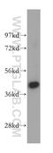 Tropomodulin 2 antibody, 15262-1-AP, Proteintech Group, Western Blot image 