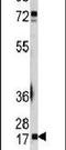 Ubiquitin Conjugating Enzyme E2 I antibody, PA5-11191, Invitrogen Antibodies, Western Blot image 