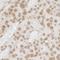 FUS RNA Binding Protein antibody, NB100-565, Novus Biologicals, Immunohistochemistry paraffin image 