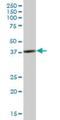 SH3 Domain Containing GRB2 Like 3, Endophilin A3 antibody, H00006457-B01P, Novus Biologicals, Western Blot image 